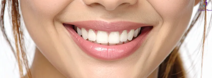Bridal & Wedding Dentistry