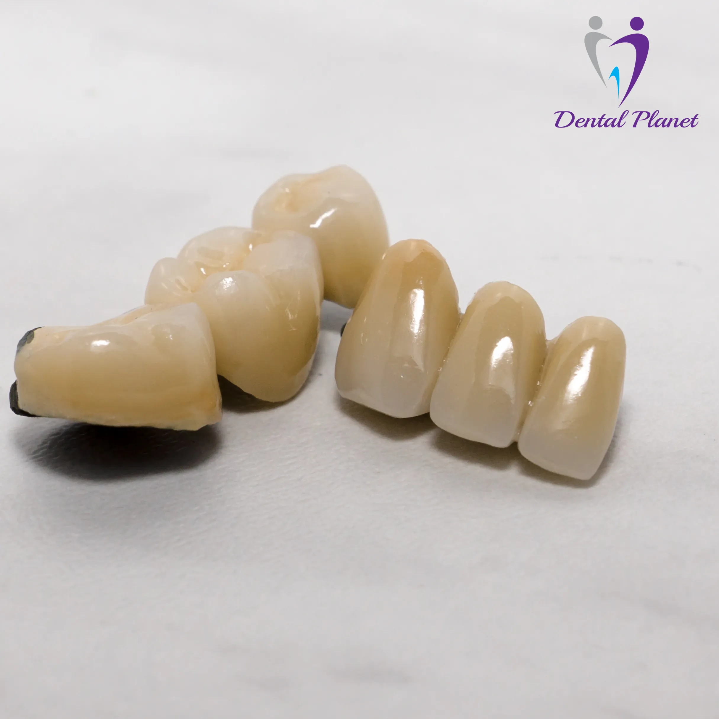 Best Dentist in Mysore