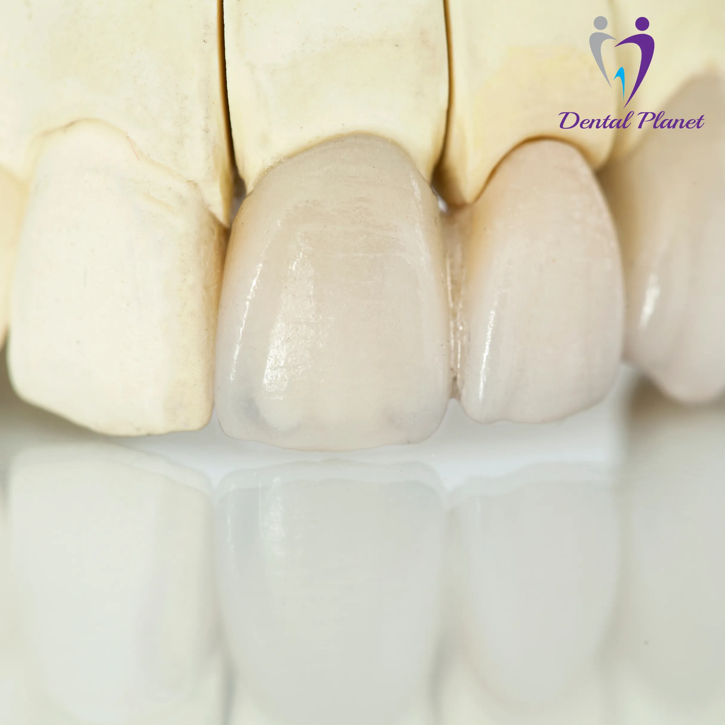 Best Dentist in Mysore